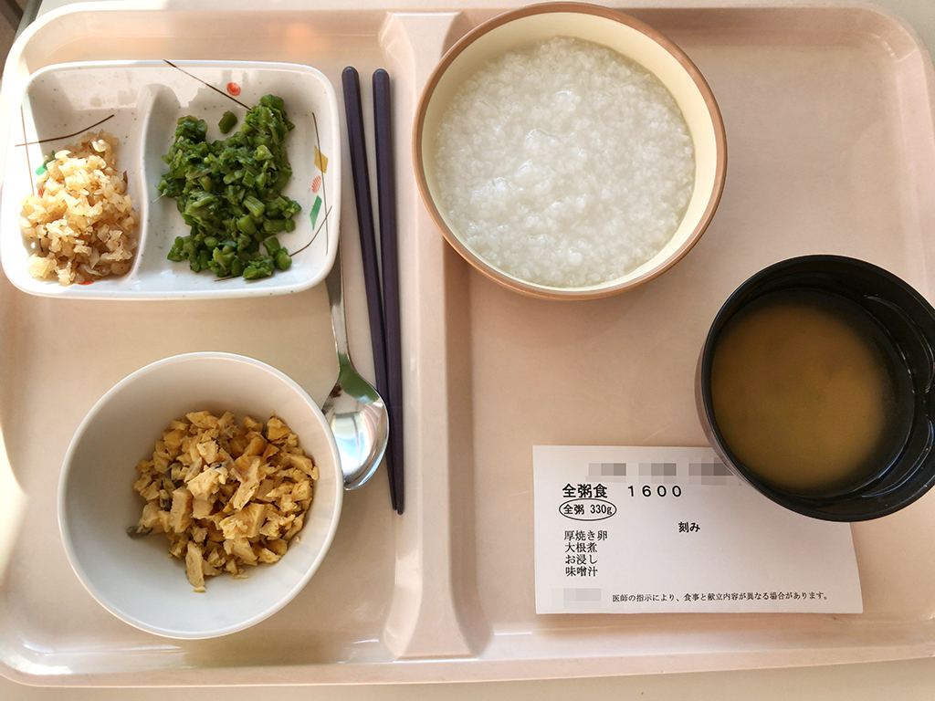 親知らず 抜歯 食べ物